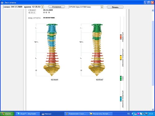 Экспресс-метод Лидомед-Био